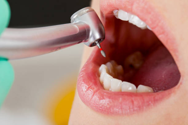 Best Dentist Open on Weekends [placeholder7] in Shell Ridge, CA